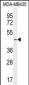 LEF1 Antibody (N-term)